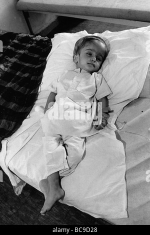 iraq baghdad pediatrric hospital saddam hussein Hydrocephalous child Stock Photo