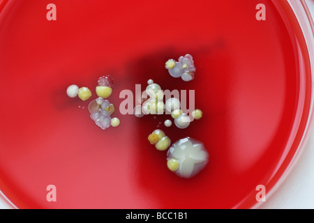 Petri dishes containing colonies of Staphylococcus Epidermidis, Staphylococcus aureus,Beta-haemolytic Streptococcu & micrococcus Stock Photo