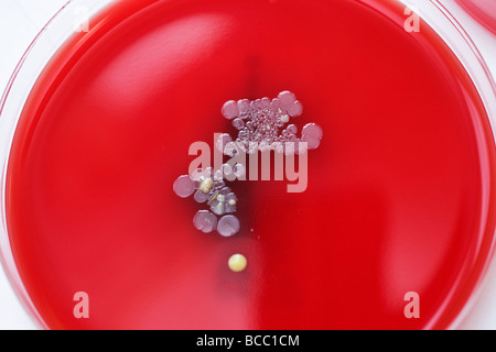 Petri dishes containing colonies of Staphylococcus Epidermidis & Staphylococcus aureus Stock Photo