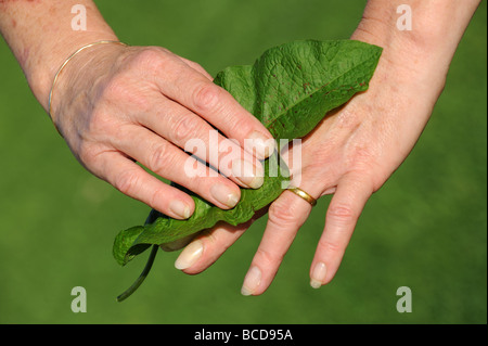 Treating a nettle sting with a Dock Leaf Stock Photo