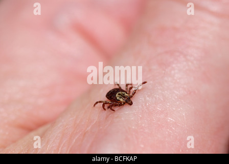 Female American dog tick, Dermacentor variabilis, also known as the wood tick It is on a person's hand. Stock Photo