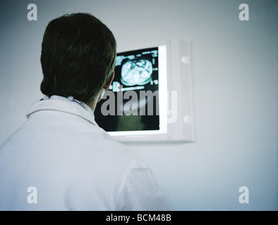 Doctor looking at MRI image, over the shoulder view Stock Photo