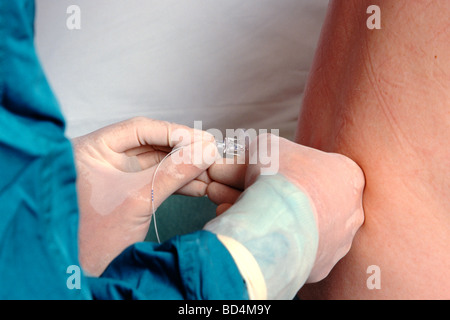 Epidural being given to a woman for pain relief during childbirth Stock Photo