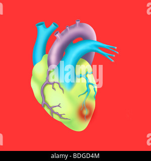 HEART ATTACK, DRAWING Stock Photo - Alamy