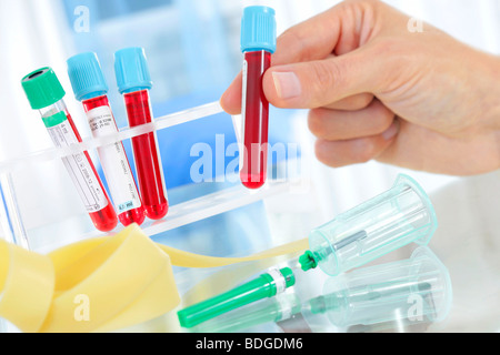 BLOOD SPECIMEN Stock Photo