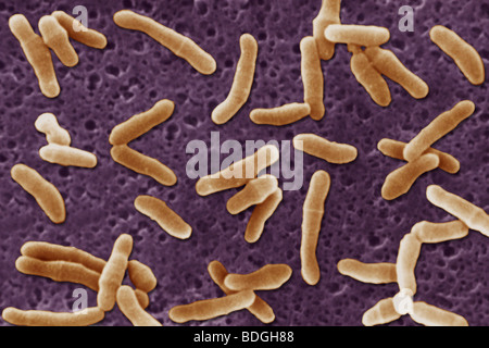 Corynebacterium diphtheriae фото