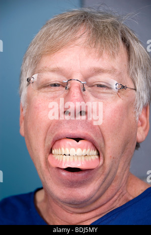 A man displays his false teeth (dentures) which shows what happens when you don't have good dental hygiene. Stock Photo