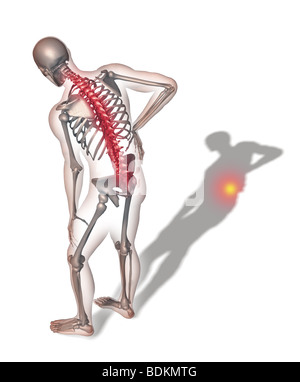 Illustration depicting back pain Stock Photo