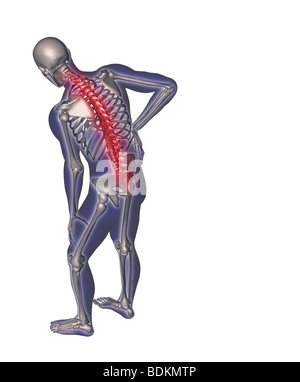Illustration depicting back pain Stock Photo