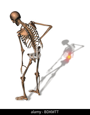 Illustration depicting back pain Stock Photo