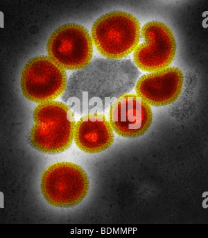 Negative-stained transmission electron micrograph (TEM) of a number of influenza virus particles