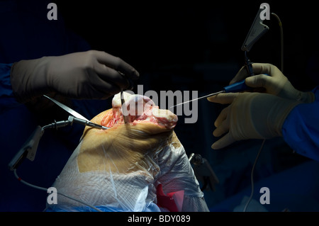 A patient undergoes knee replacement surgery at a West Midlands hospital, after being diagnosed with irreparable damage Stock Photo