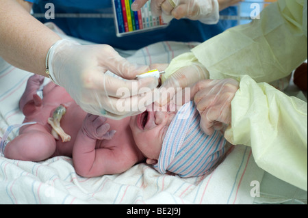 Newborn hispanic baby is given prophylactic eye drops immediately after birth to prevent infection. Baby is model released. Stock Photo