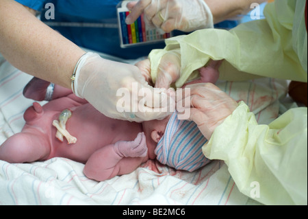 Newborn hispanic baby is given prophylactic eye drops immediately after birth to prevent infection. Baby is model released. Stock Photo