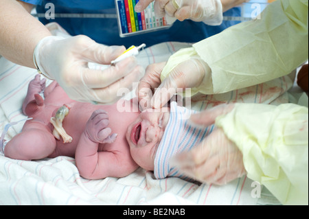 Newborn hispanic baby is given prophylactic eye drops immediately after birth to prevent infection. Baby is model released. Stock Photo