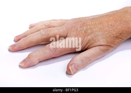 Older senior womans arthritic hand isolated against white background. Stock Photo