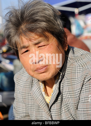 A lady is being treated with many acupuncture needles in face in a street of Congming in Shanghai, China. 11-Nov-2009 Stock Photo