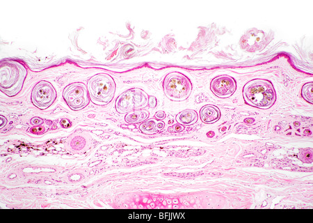 Brightfield stained photomicrograph of mammal hair follicles in skin (cross section seen from above) Stock Photo