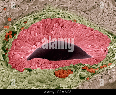 Foetal sense organ, SEM Stock Photo