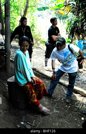 A Karen women suffering from Elephantiasis with  bloated leg talking with journalist , mae la refugee camp , near mae sot Stock Photo