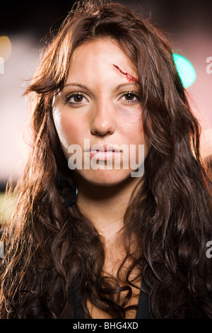 Teenage girl with facial injuries Stock Photo