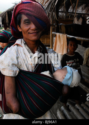 disabled karen refugee with no hands carrying  baby,umpium refugee camp(thai burmese border) , south of mae sot , tak,thailand Stock Photo