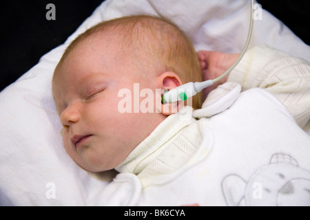 Newborn / new born baby undergoes a neonatal hearing screening test: Automated otoacoustic emissions test. Stock Photo