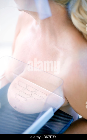 Mammography Stock Photo