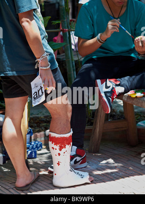 Leg in a plaster. Boy with his cast and humorous decoration by artist. Thailand S. E. Asia Stock Photo