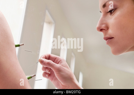 Acupuncturist applying needles and herbal cigars on a person's arm Stock Photo