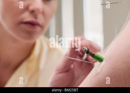 Acupuncturist applying needles and herbal cigars on a person's arm Stock Photo