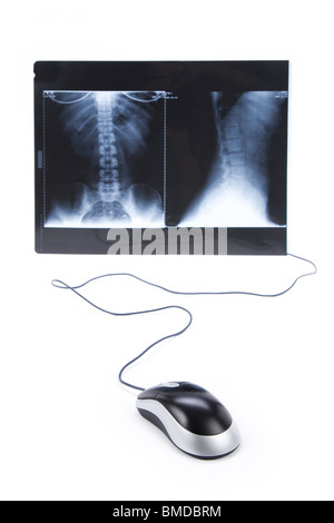 x-ray image and computer mouse, concept modern medical diagnoses Stock Photo