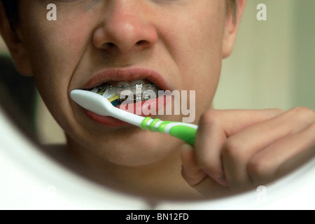 Teenage boy with dental braces brushing teeth in mirror Stock Photo