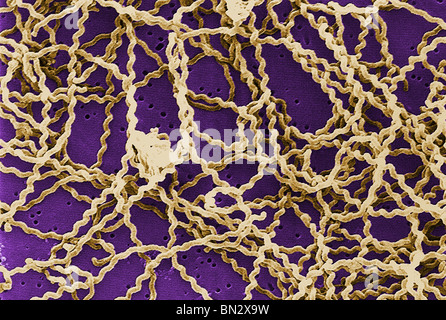 Scanning electron micrograph (SEM) showing a number of Leptospira sp. bacteria atop a 0.1. µm polycarbonate filter. Stock Photo