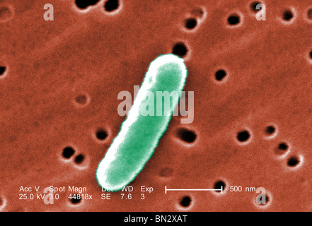 Colorized scanning electron micrograph (SEM) of a a single Gram-negative Escherichia coli bacterium Stock Photo