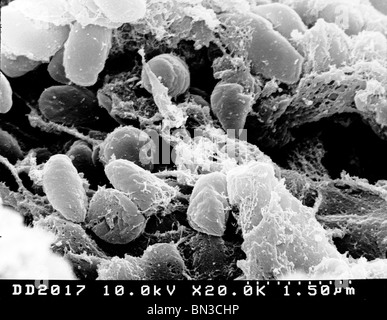 Scanning electron micrograph depicting a mass of Yersinia pestis bacteria (the cause of bubonic plague) Stock Photo