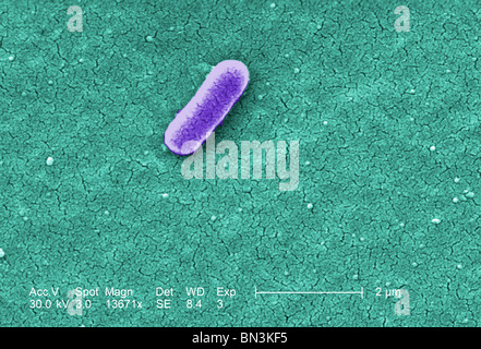 Colorized scanning electron micrograph of Escherichia coli O157:H7 at a magnification of 13671x Stock Photo