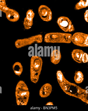 Transmission Electron Micrograph (TEM) of Bacillus subtilis bacteria ...
