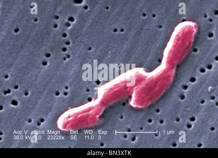 Scanning electron micrograph (SEM) of four highly magnified rod-shaped, motile, Gram-negative Salmonella infantis bacteria Stock Photo