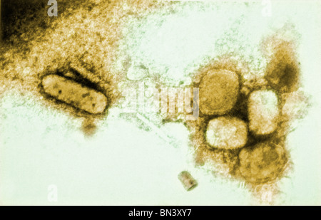 Transmission electron micrograph of variola, the smallpox virus using a negative stain technique; Magnification 65,000X Stock Photo