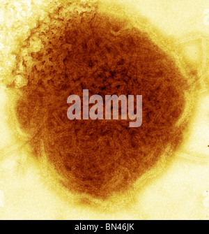 Negative stained transmission electron micrograph (TEM) of mumps virus