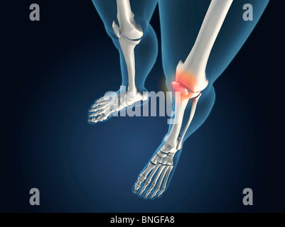 X-ray view of knees with joint inflammations Stock Photo - Alamy