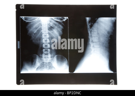 body x-ray photo for background Stock Photo