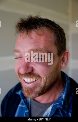 man with black eye Stock Photo