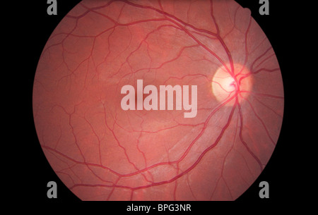 normal retina arteries and veins