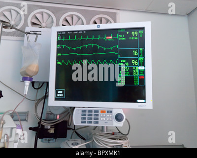 London England Private Intensive Care Unit Hospital Monitor Showing Heart Rate Stock Photo