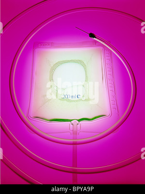 IV bag  with a tube and a needle shot on illuminating pink background. Tube and needle are creating a circular pattern. Stock Photo