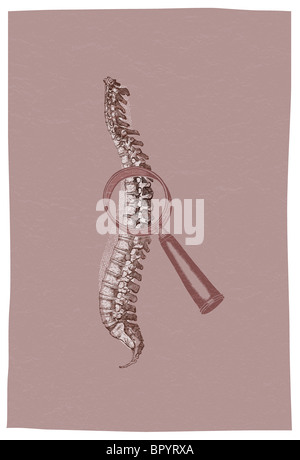 A magnifying glass on the vertebrae of a spinal column Stock Photo