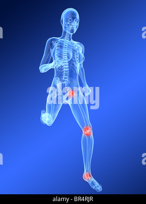 painful knee and hip illustration Stock Photo