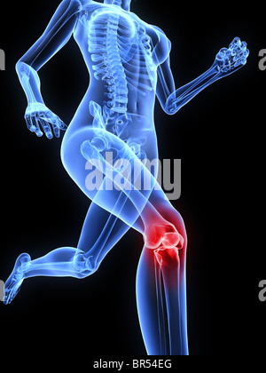 painful knee illustration Stock Photo